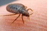 Bed Bug Exterminator Bed Bug Exterminators Bed Bug Exterminator Jacksonville fl Bed Bug Extermination companies Jacksonville fl Bed Bug Extermination company Jacksonville fl Bed Bug Extermination Jacksonville fl Bed Bug Extermination service Jacksonville fl Bed Bug Extermination services Jacksonville fl bed bug exterminator cost jacksonville fl